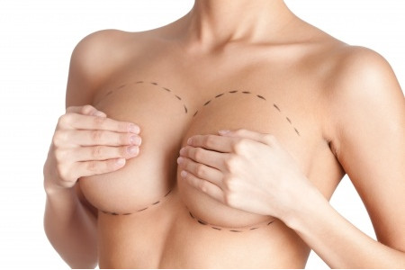 Smart mastoplastica: un seno nuovo in 30 minuti